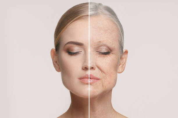 Comparison of young and aged skin on woman's face showing effects of aging and skincare