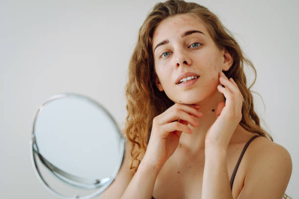 The Ultimate Guide to Skin Types & Acne Prevention: Maintain Clear, Radiant Skin